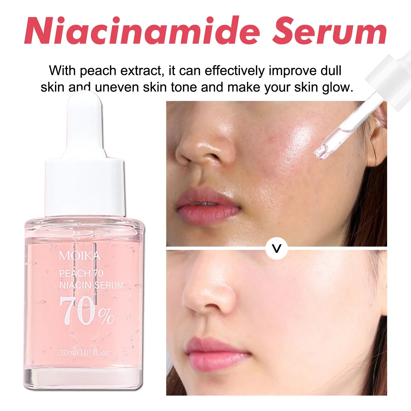 Niacinamide Serum Dark Spot Remover